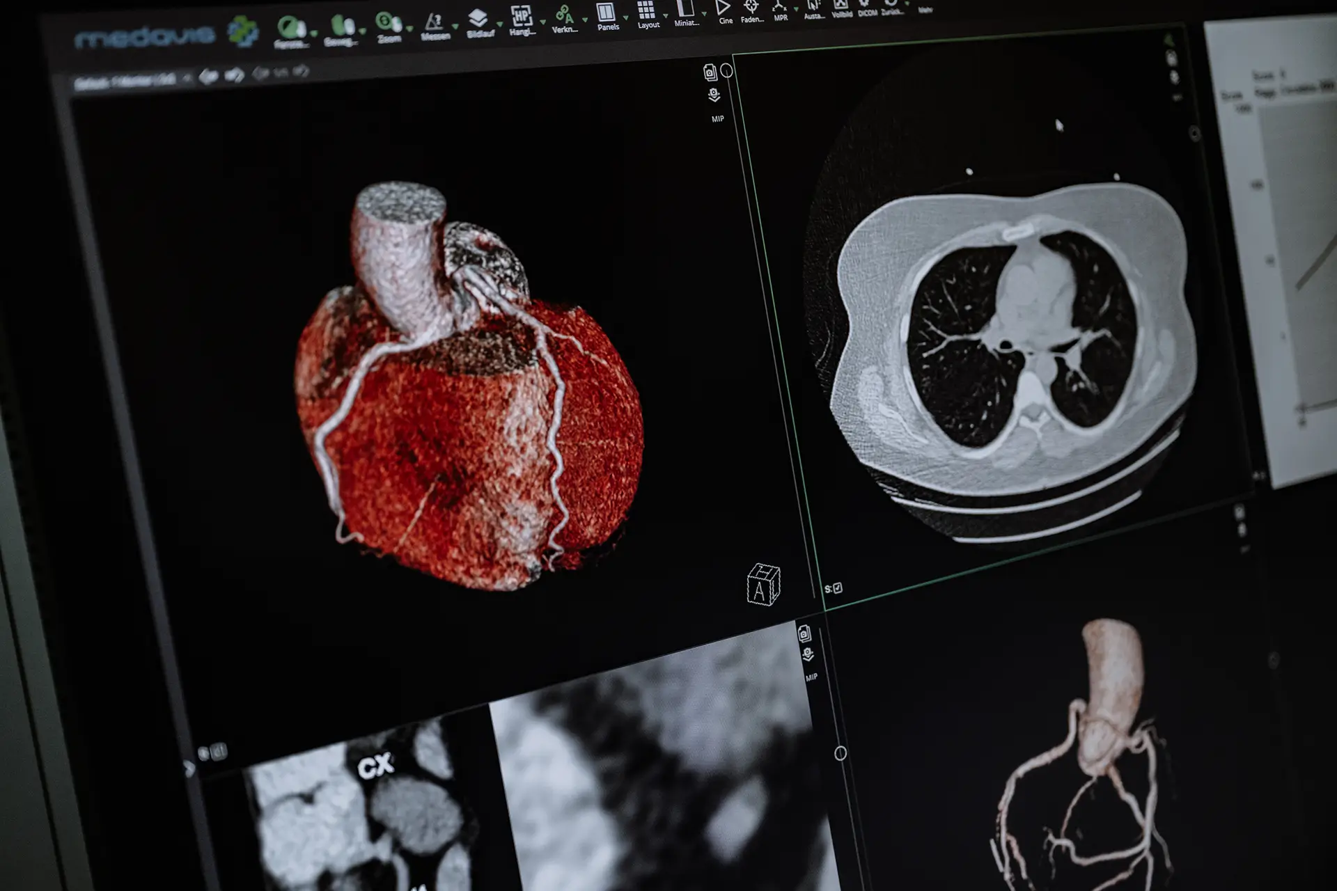 Ergebnisse eines CT-Scans