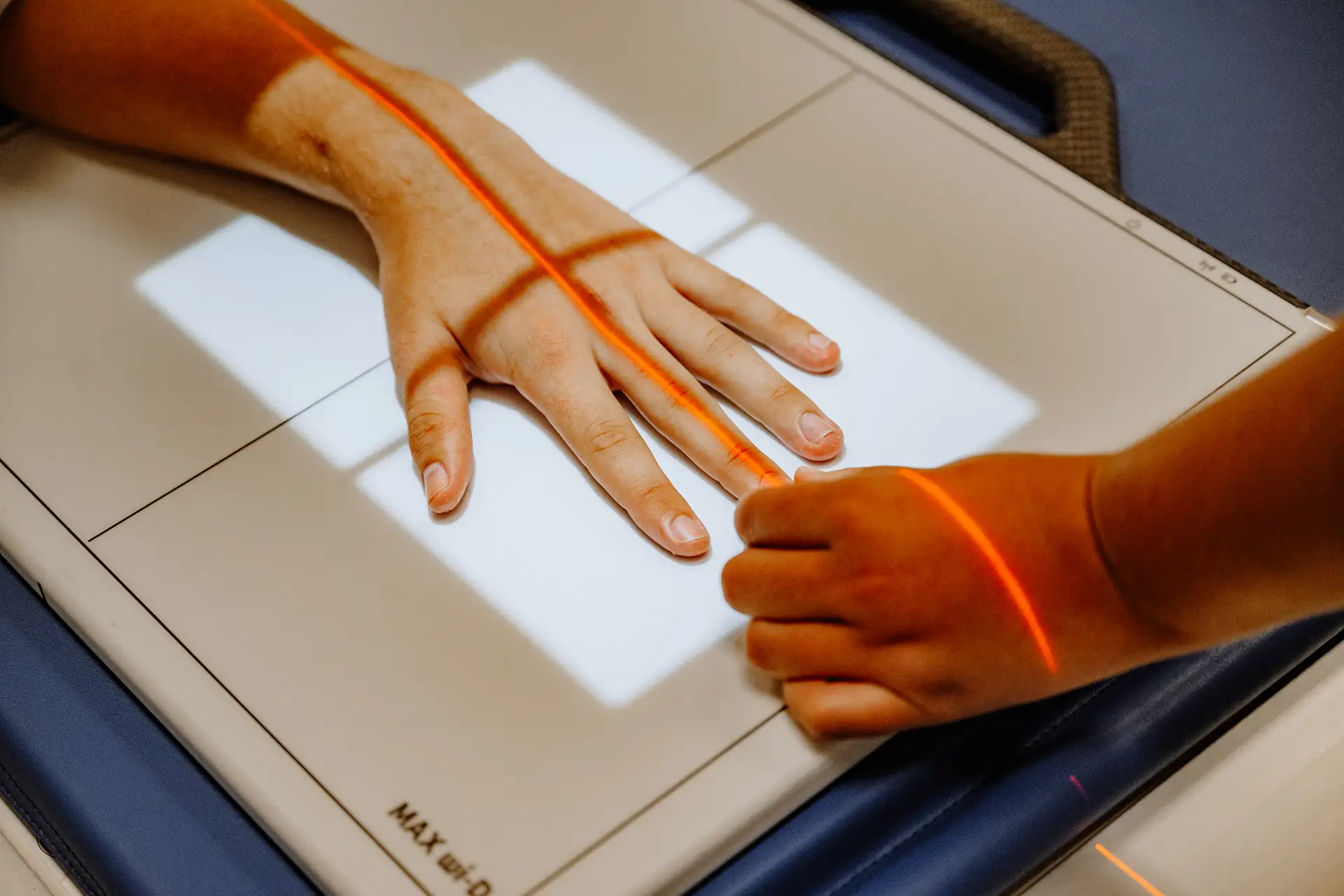Nahaufnahme einer Hand bei der Positionierung für eine digitale Röntgenaufnahme mit Lasermarkierung.