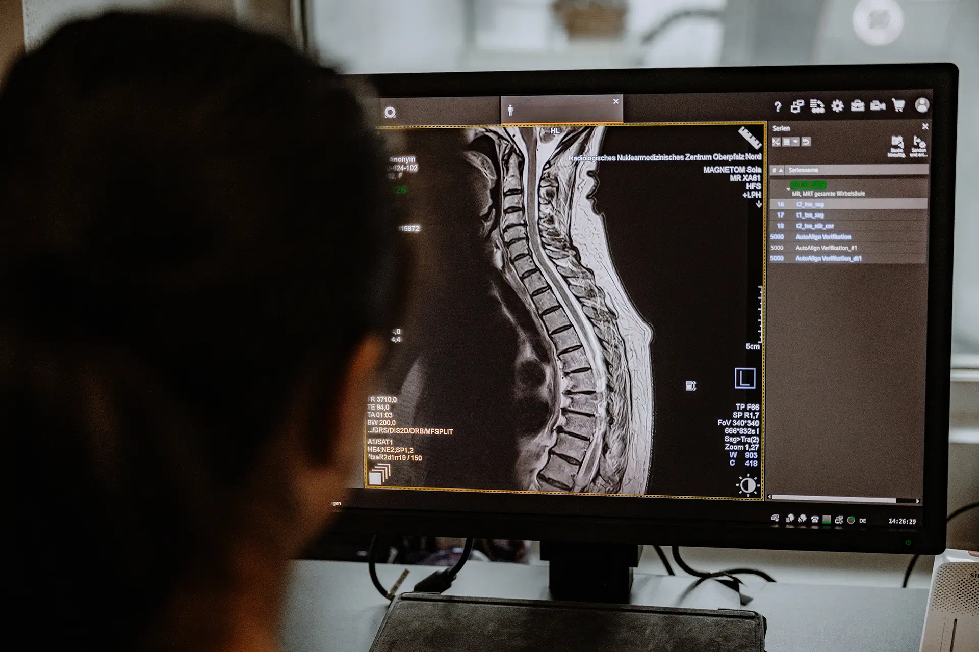 MRT-Aufnahme der Wirbelsäule auf einem Diagnosemonitor im RNZ Oberpfalz Nord.